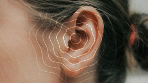 ¿Qué es el Tinnitus?